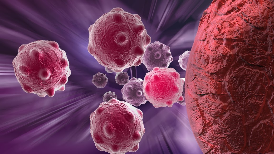 Clinical Trial: New Immune-Stimulating Drug Can Shrink Pancreatic Tumors