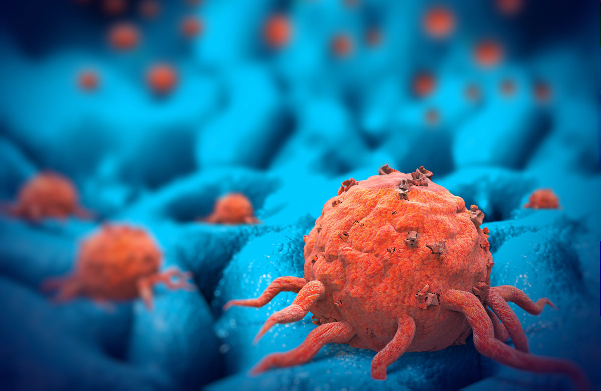Pioneering A New 3-D Cancer Model To Speed New Treatments