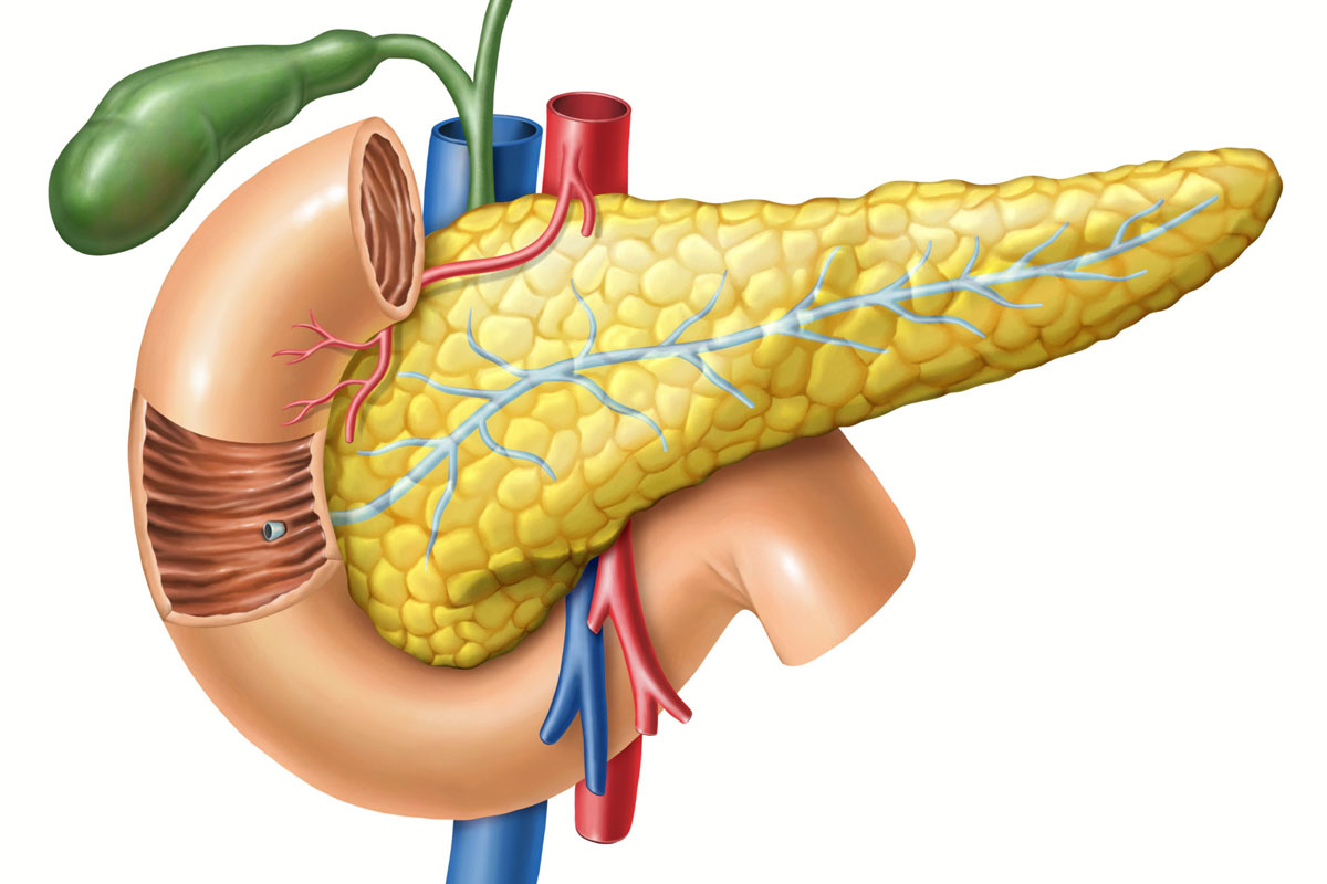 Can Pancreatic Patients Have A Pancreas Transplant?