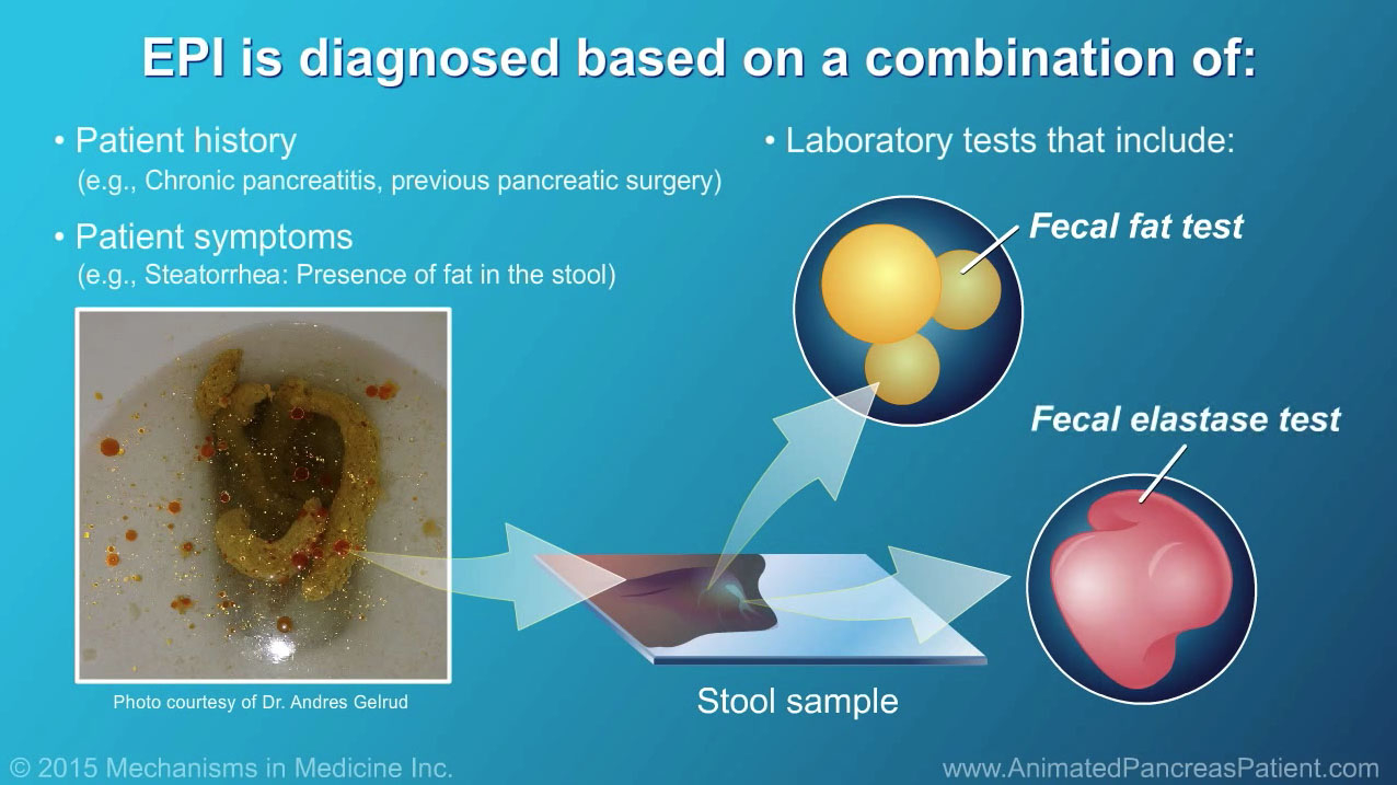 What is Pancreatic Enzyme Replacement Therapy? Seena Magowitz Foundation