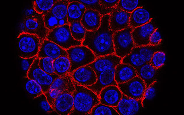 “Drug combination inhibits genes that drive aggressive pancreatic cancer, study finds”